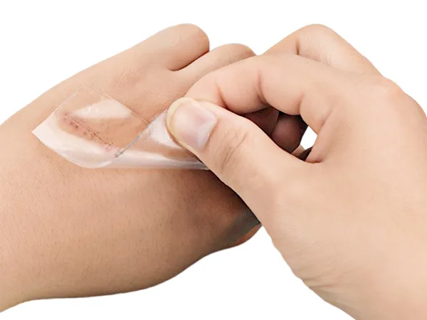 Láminas de gel de silicona para cicatrices